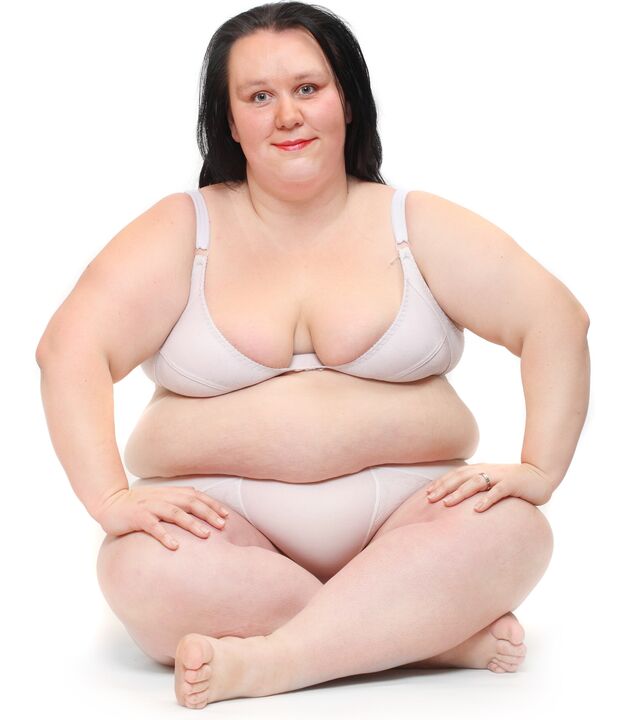 Υπέρβαρη γυναίκα